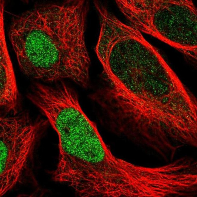 UBE2E2 Antibody in Immunocytochemistry (ICC/IF)