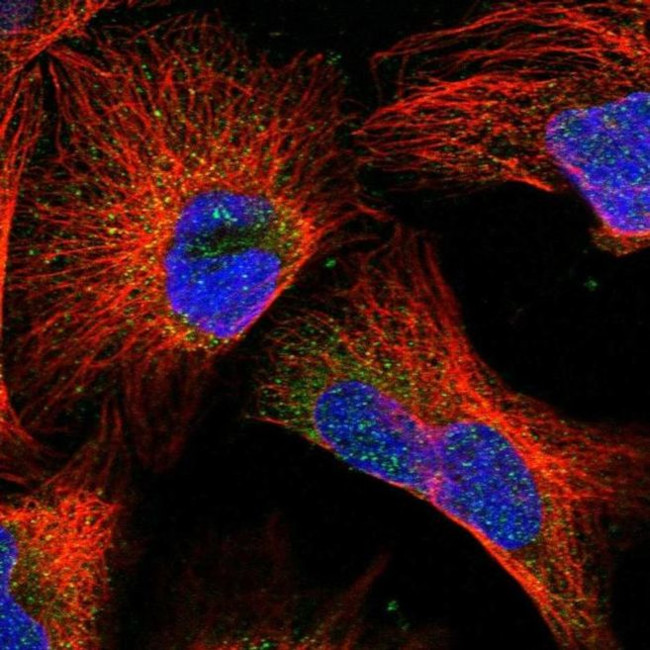 DAD1 Antibody in Immunocytochemistry (ICC/IF)