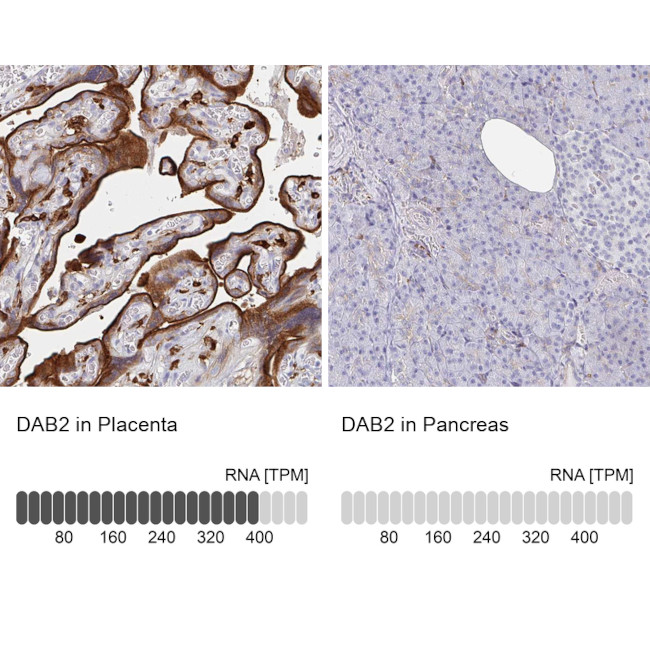 DAB2 Antibody in Immunohistochemistry (IHC)