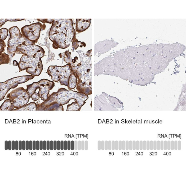 DAB2 Antibody