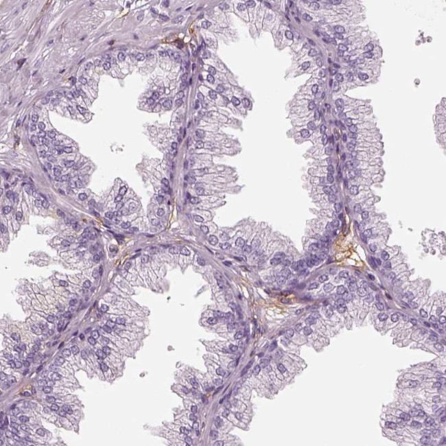 RNF36 Antibody in Immunohistochemistry (IHC)