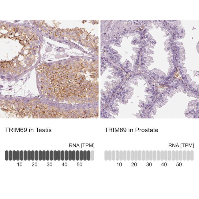 RNF36 Antibody