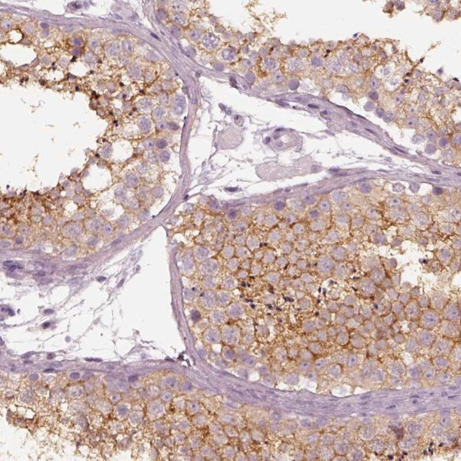 RNF36 Antibody in Immunohistochemistry (IHC)