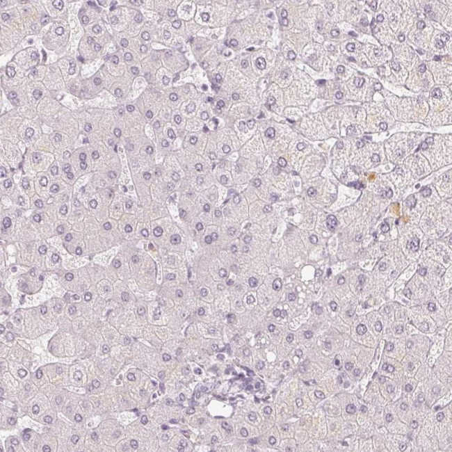 APLP1 Antibody in Immunohistochemistry (IHC)