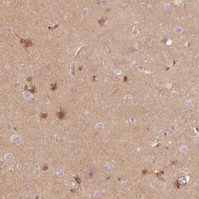 APLP1 Antibody in Immunohistochemistry (IHC)