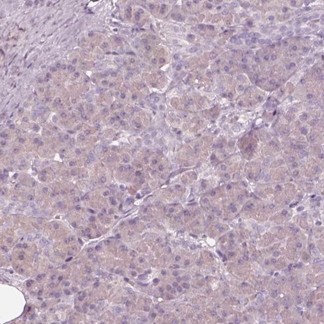 EGR4 Antibody in Immunohistochemistry (IHC)