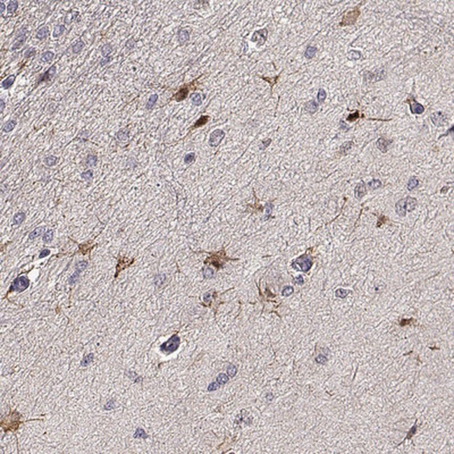 EGR4 Antibody in Immunohistochemistry (IHC)