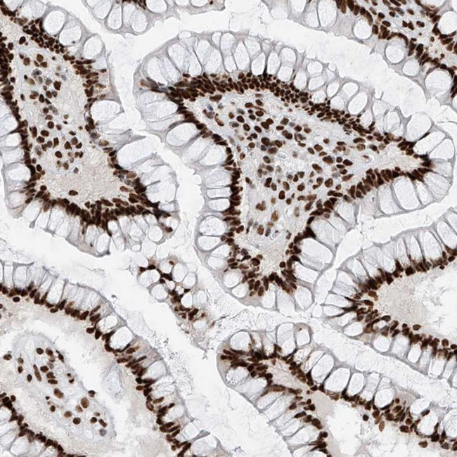 SRSF6 Antibody in Immunohistochemistry (IHC)