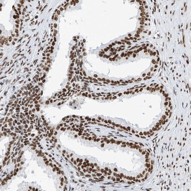 SRSF6 Antibody in Immunohistochemistry (IHC)