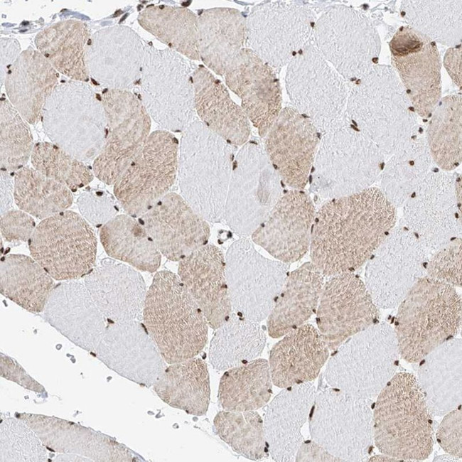 SRSF6 Antibody in Immunohistochemistry (IHC)