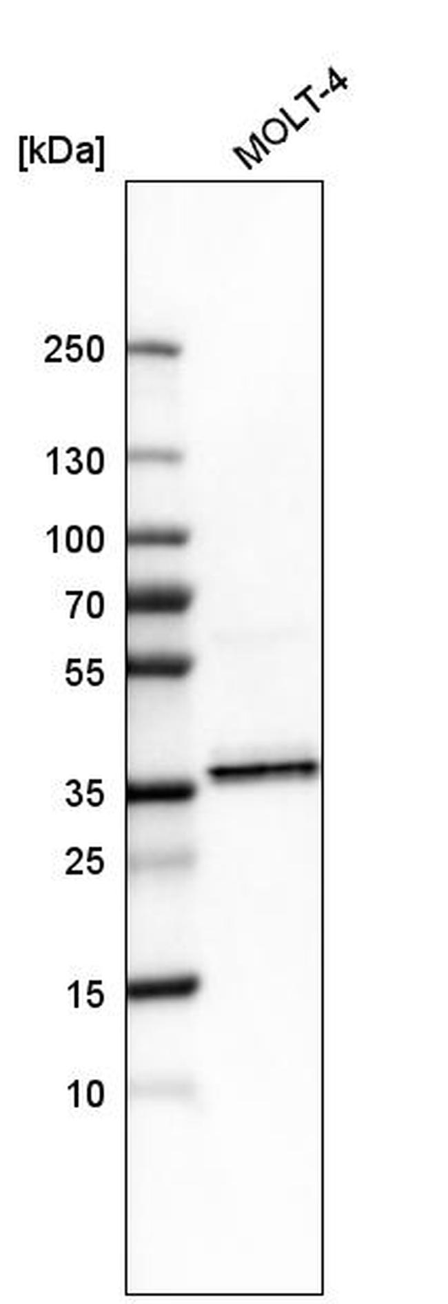 SRSF6 Antibody in Western Blot (WB)