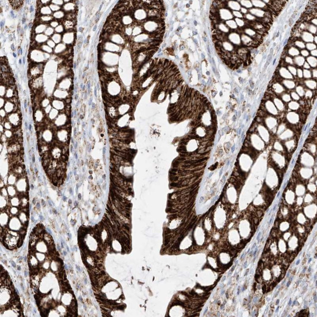 ETHE1 Antibody in Immunohistochemistry (IHC)