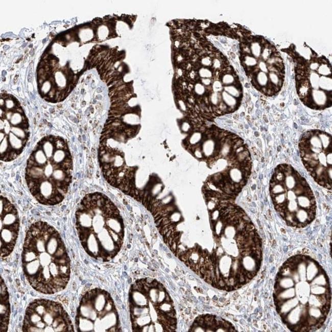 ETHE1 Antibody in Immunohistochemistry (IHC)