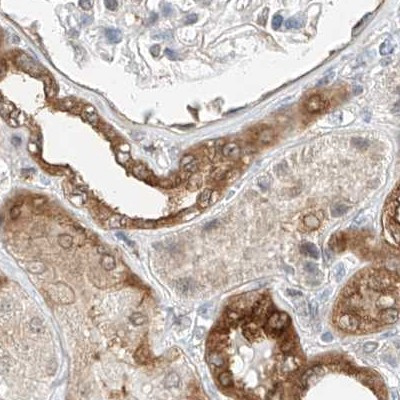 LRRC16A Antibody in Immunohistochemistry (IHC)