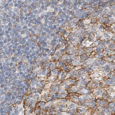 LRRC16A Antibody in Immunohistochemistry (IHC)