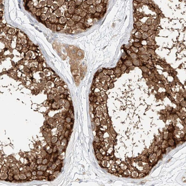 LRRC16A Antibody in Immunohistochemistry (IHC)