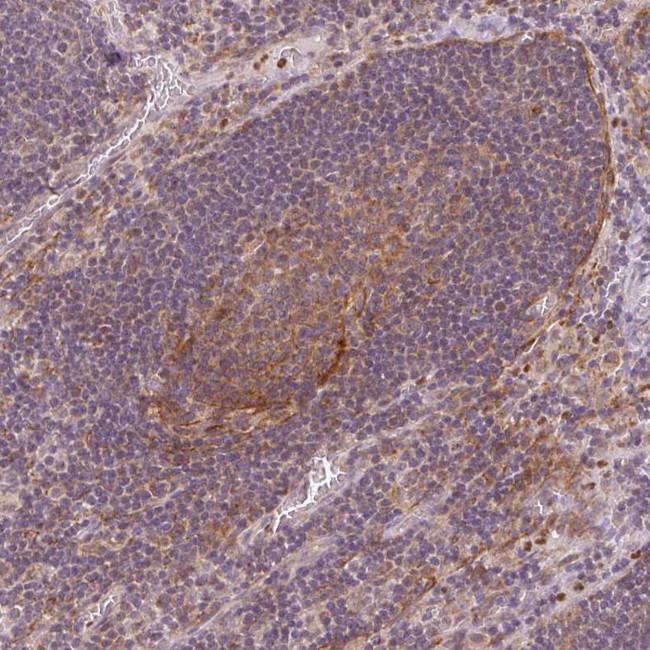 MTHFD1L Antibody in Immunohistochemistry (IHC)