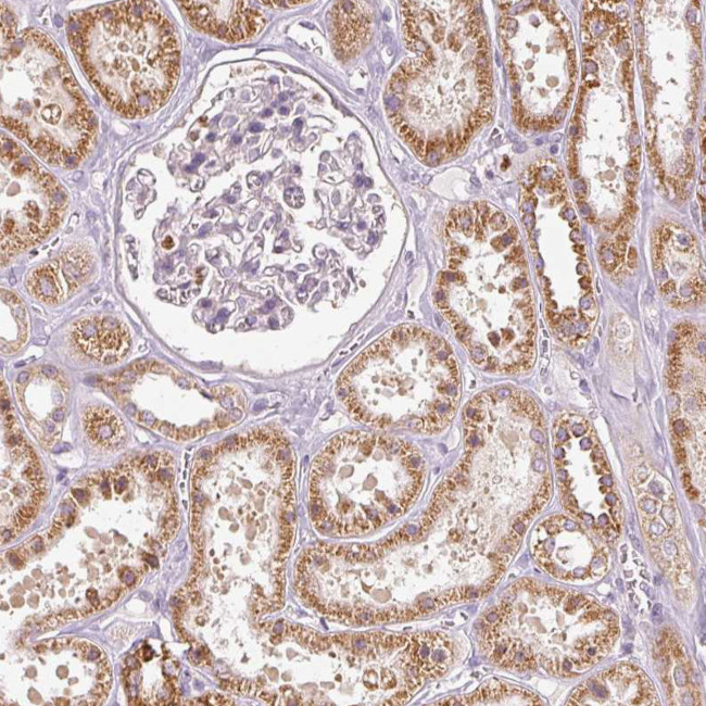 MTHFD1L Antibody in Immunohistochemistry (IHC)