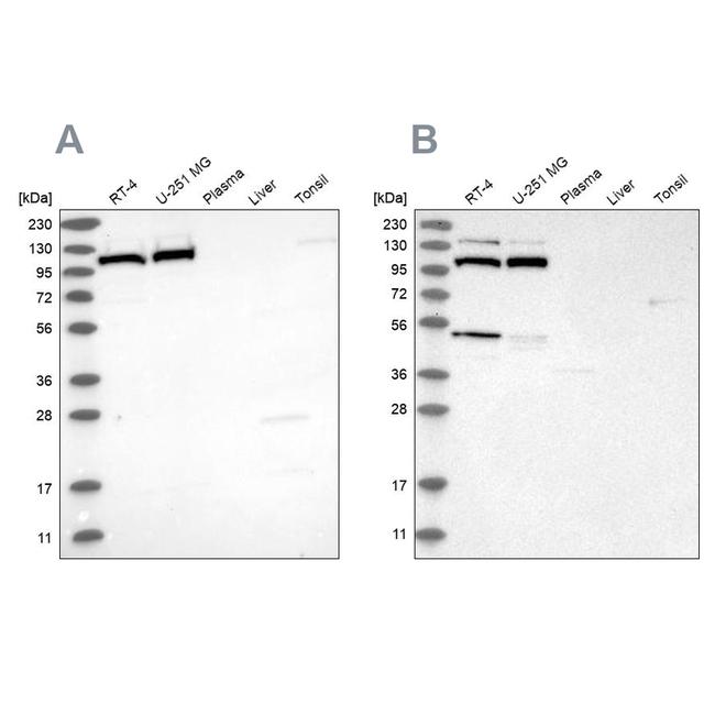 MTHFD1L Antibody in Western Blot (WB)