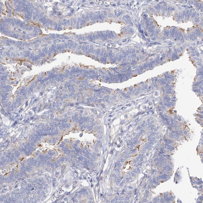 LCA5 Antibody in Immunohistochemistry (IHC)