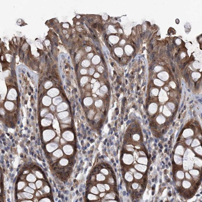 NT5C3A Antibody in Immunohistochemistry (IHC)