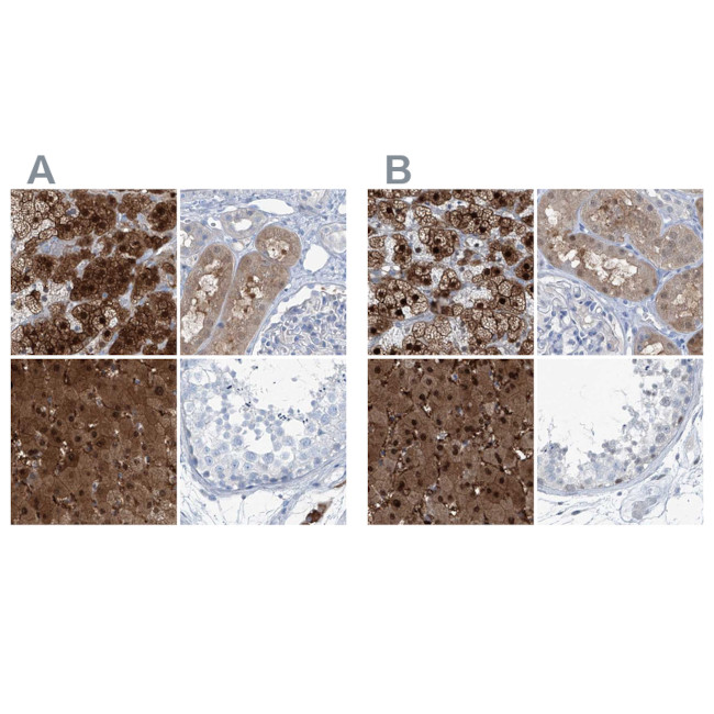 RGN Antibody in Immunohistochemistry (IHC)