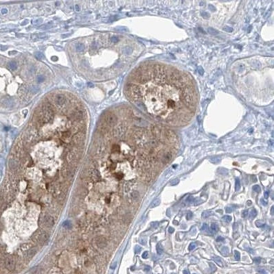 RGN Antibody in Immunohistochemistry (IHC)