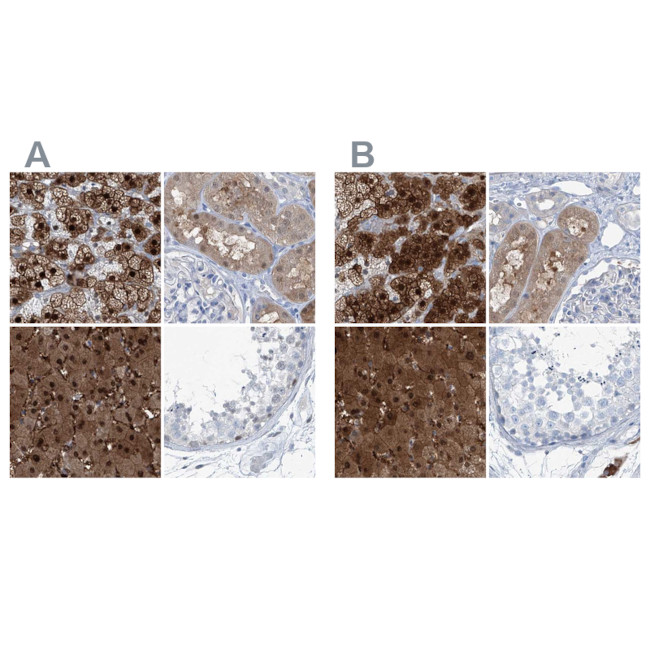 RGN Antibody in Immunohistochemistry (IHC)