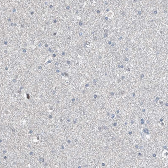 RGN Antibody in Immunohistochemistry (IHC)