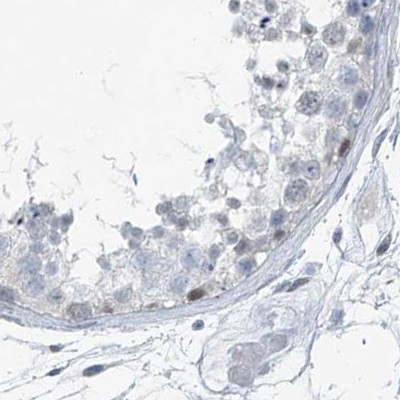 RGN Antibody in Immunohistochemistry (IHC)