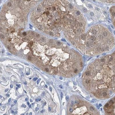 RGN Antibody in Immunohistochemistry (IHC)