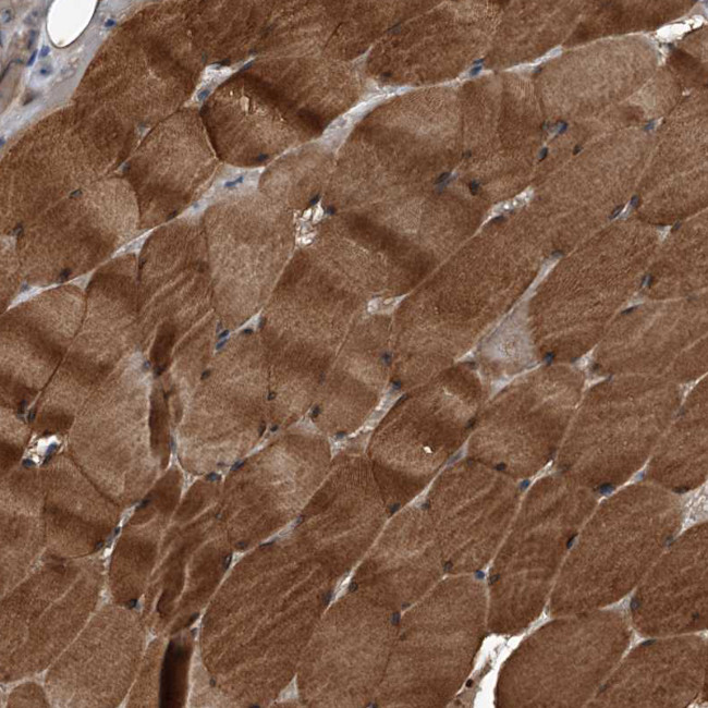 Kir2.1 (KCNJ2) Antibody in Immunohistochemistry (IHC)