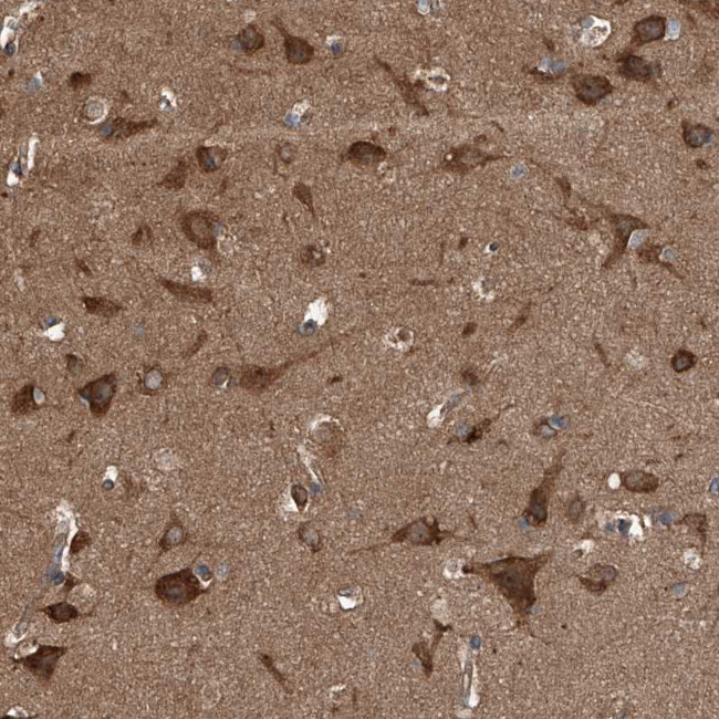 Kir2.1 (KCNJ2) Antibody in Immunohistochemistry (IHC)