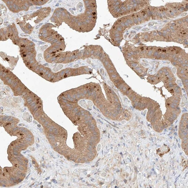 RAB23 Antibody in Immunohistochemistry (IHC)