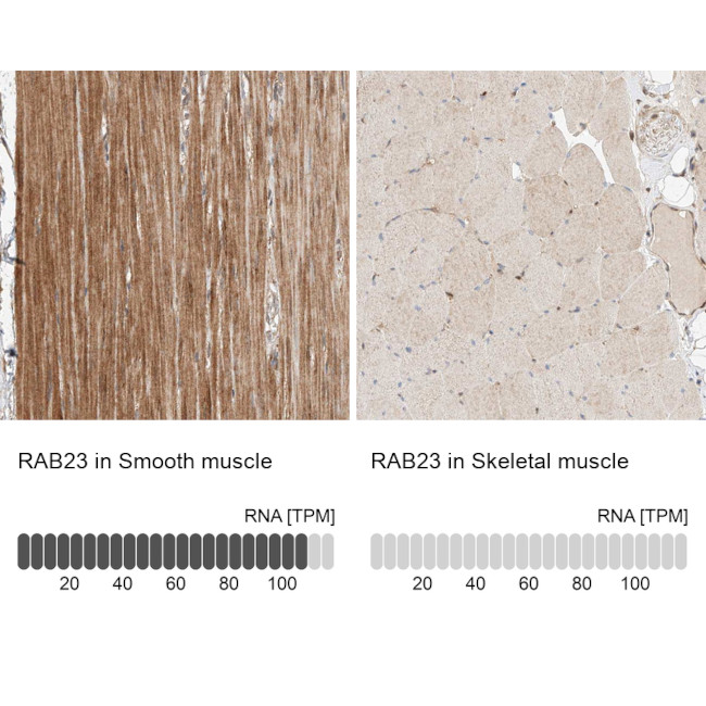 RAB23 Antibody in Immunohistochemistry (IHC)