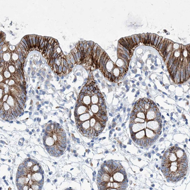 FPR2 Antibody in Immunohistochemistry (IHC)