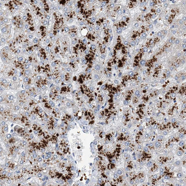 FPR2 Antibody in Immunohistochemistry (IHC)