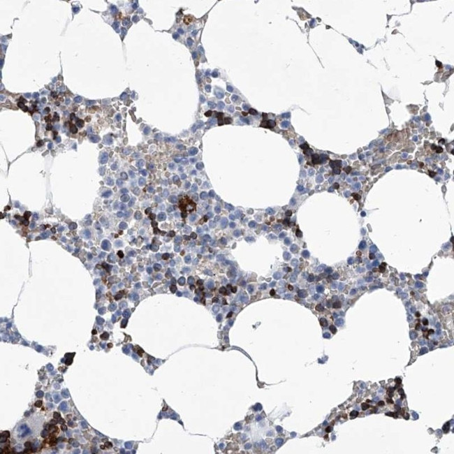 FPR2 Antibody in Immunohistochemistry (IHC)