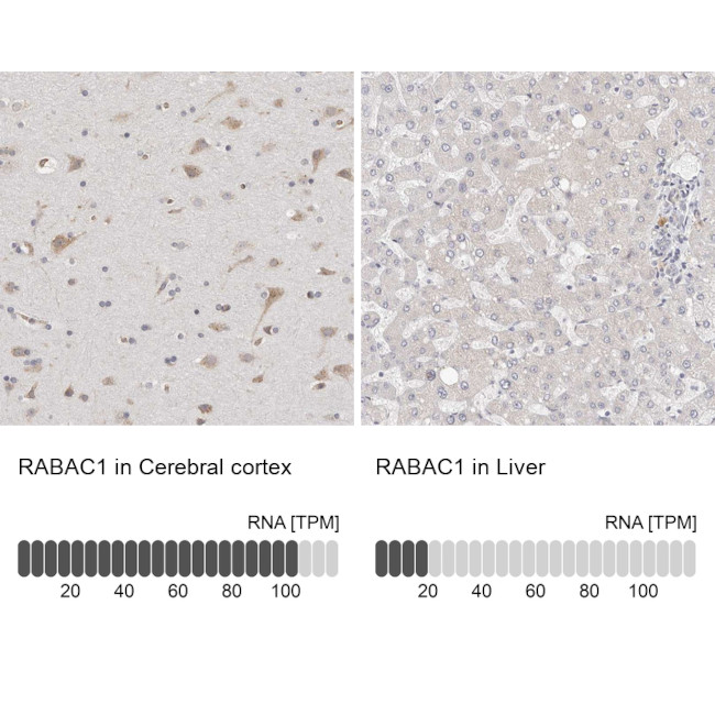 RABAC1 Antibody in Immunohistochemistry (IHC)