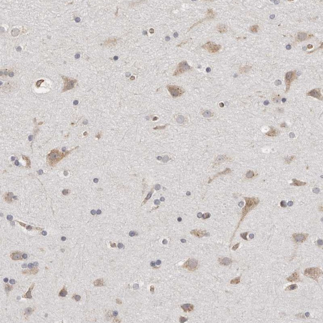 RABAC1 Antibody in Immunohistochemistry (IHC)