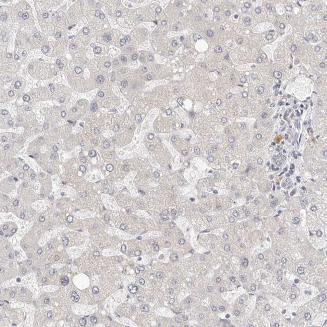 RABAC1 Antibody in Immunohistochemistry (IHC)