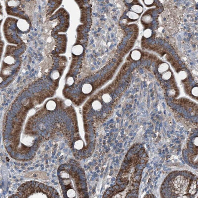 AGPAT9 Antibody in Immunohistochemistry (IHC)