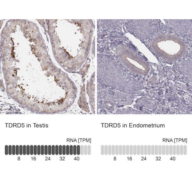 TDRD5 Antibody