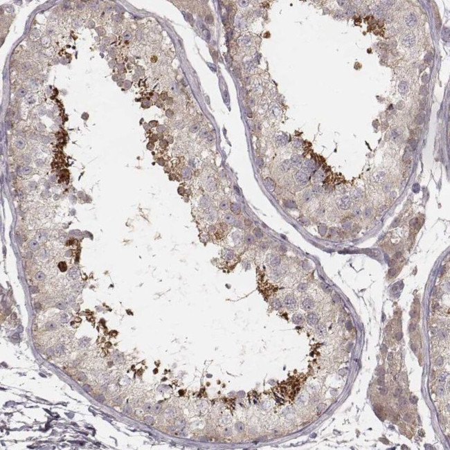 TDRD5 Antibody in Immunohistochemistry (IHC)