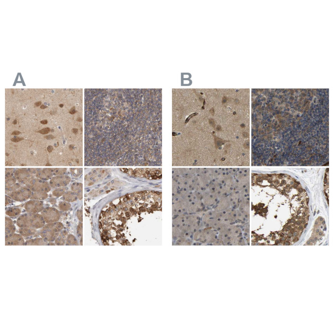 TCP-1 theta Antibody in Immunohistochemistry (IHC)