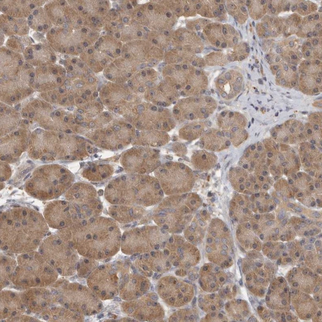 TCP-1 theta Antibody in Immunohistochemistry (IHC)