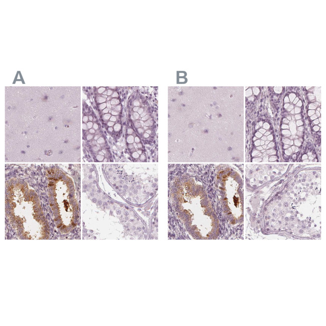 PAEP Antibody in Immunohistochemistry (IHC)