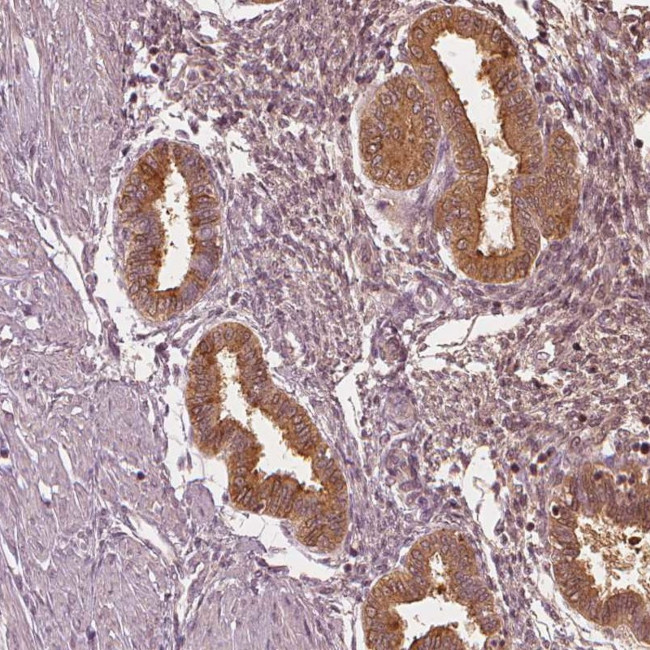 PAEP Antibody in Immunohistochemistry (IHC)