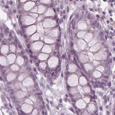 PAEP Antibody in Immunohistochemistry (IHC)