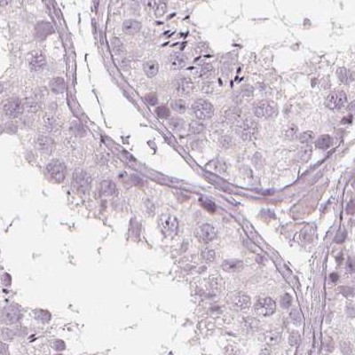 PAEP Antibody in Immunohistochemistry (IHC)